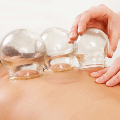 Cupping therapy session with athlete